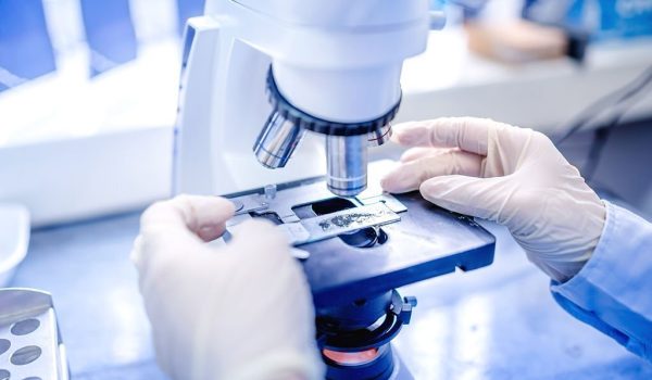 scientist hands with microscope, examining samples and liquid. Medical research with technical equipment